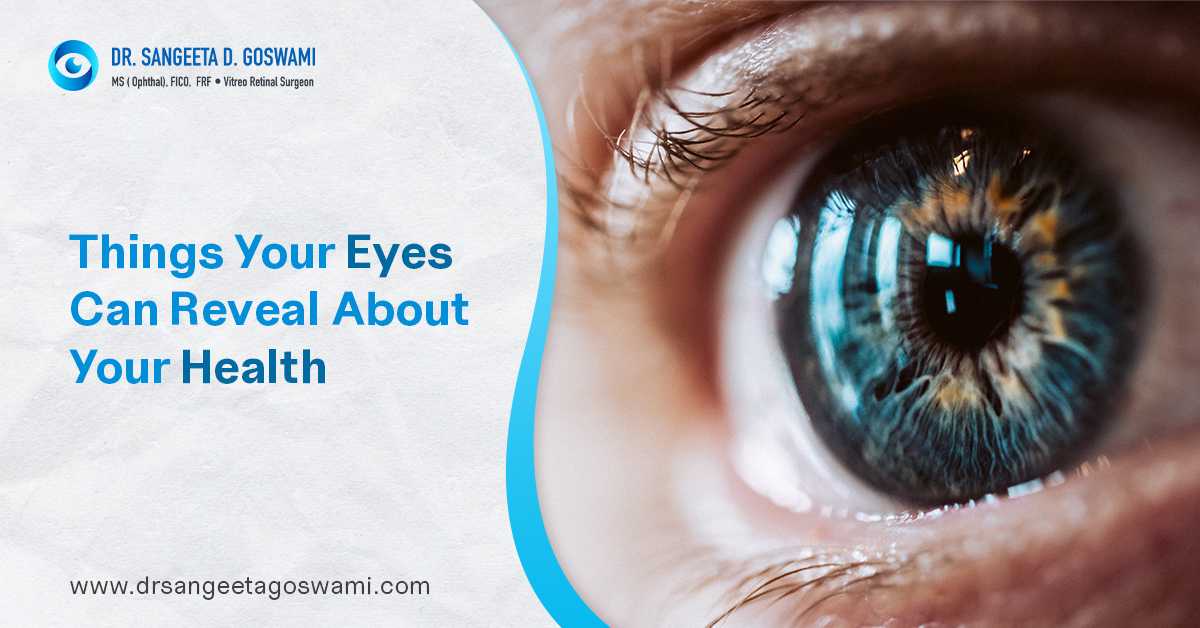 Things Your Eyes Can Reveal About Your Health