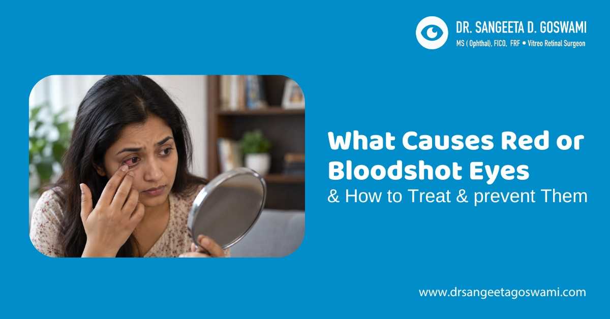 What Causes Red or Bloodshot Eyes & How to Treat & Prevent Them