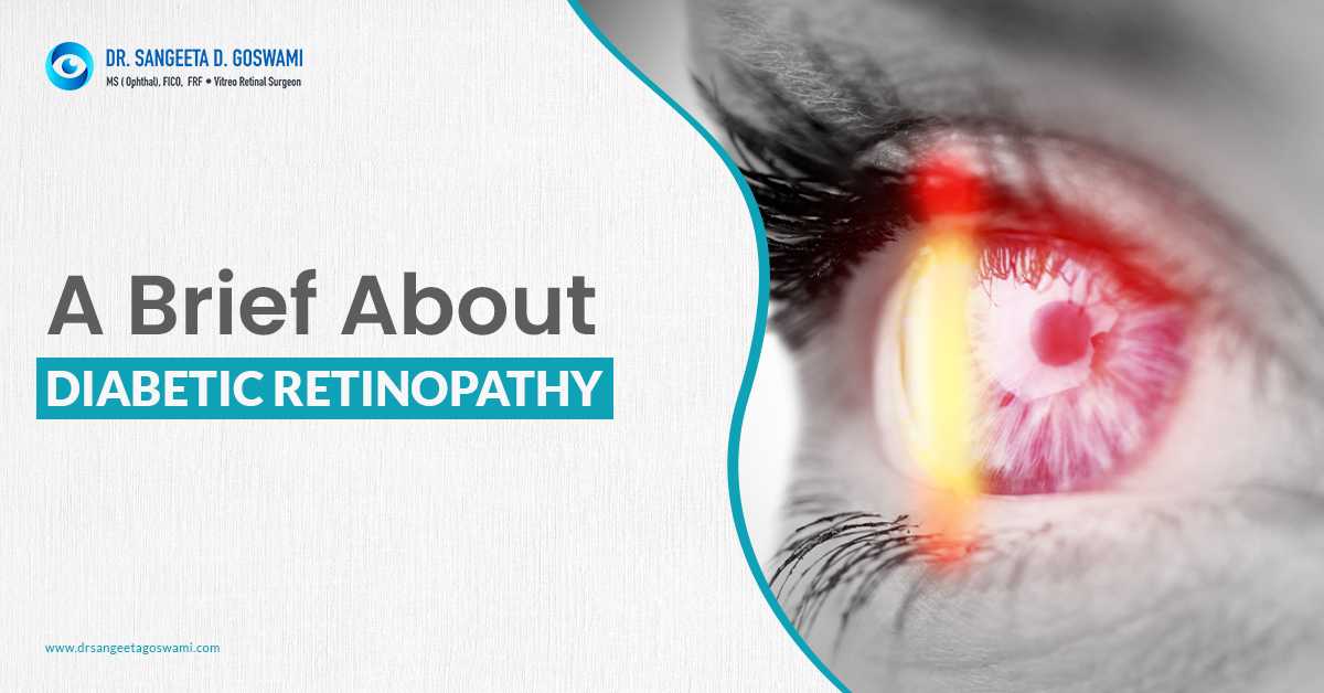 Eye Specialist Doctor in Siliguri