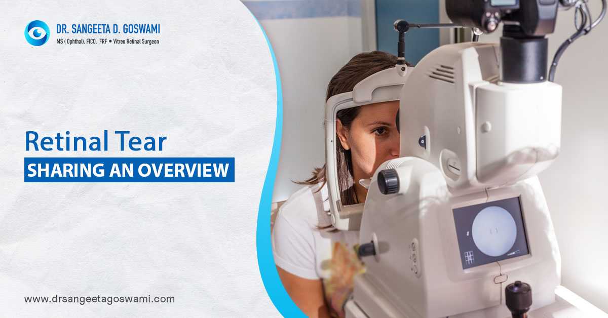Retinal Tear – Sharing An Overview