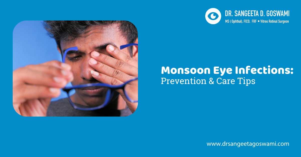 Monsoon Eye Infections: Prevention & Care Tips