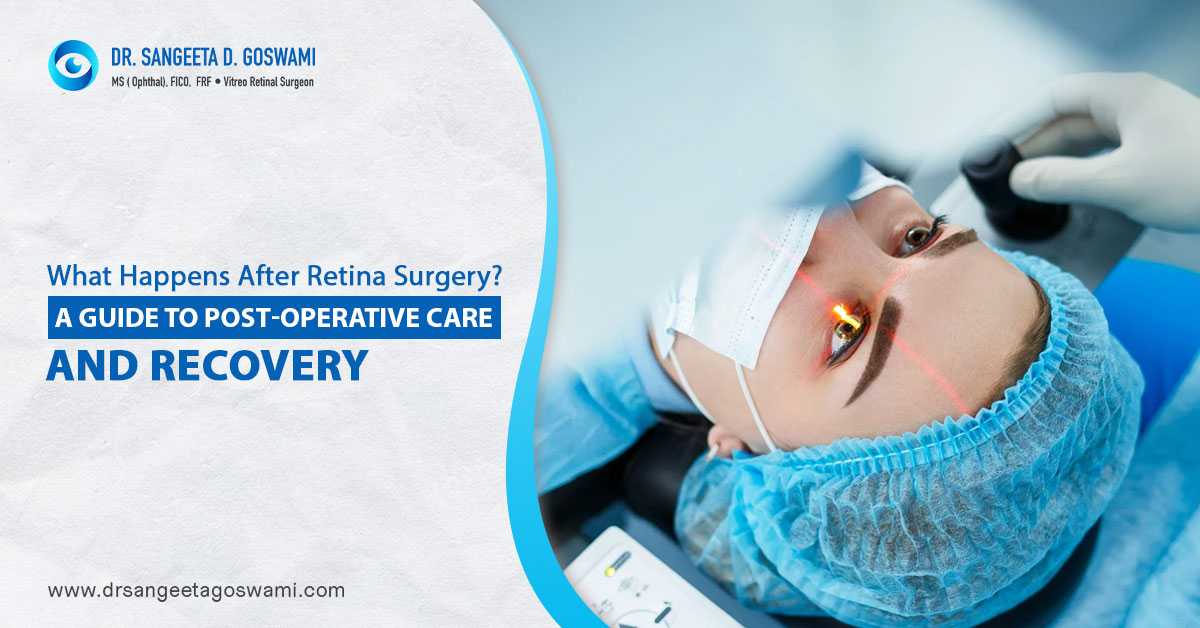 What Happens After Retina Surgery? A Guide to Post-Operative Care and Recovery