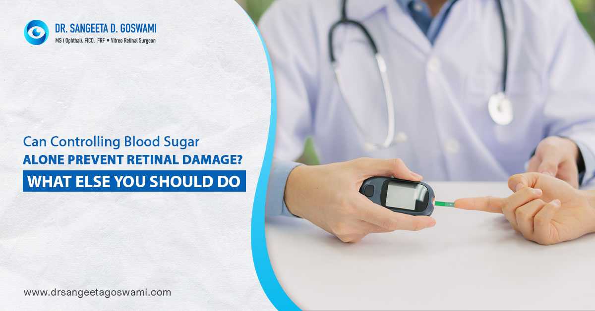 Best eye doctor in Siliguri