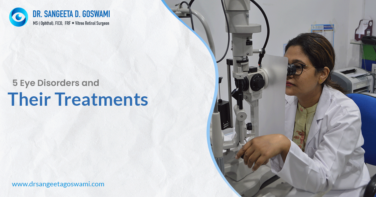 Retina Specialist in Siliguri