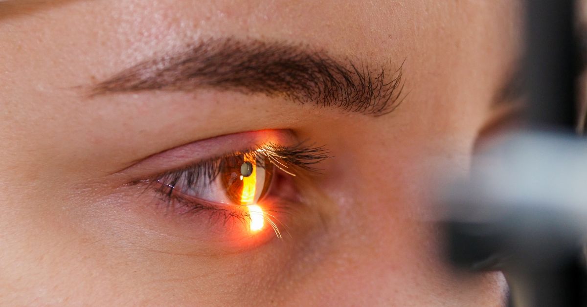 retina
